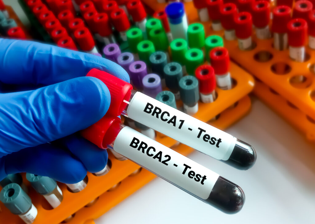brca1 and brca2 gene testing for hereditary cancer risk