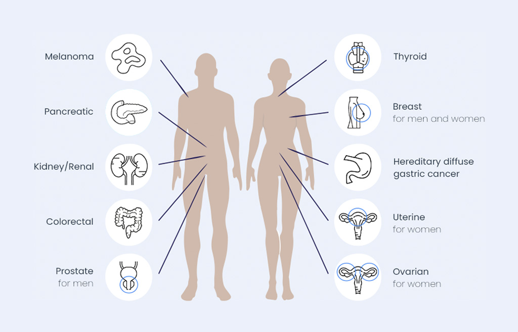Ten common types of cancer in men and women